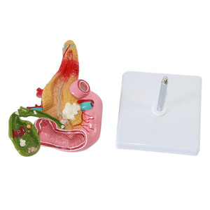 Sciedu Medical Anatomical Training Fígado Pâncreas Duodeno Modelo Patológico de modelos anatômicos da vesícula biliar - Product Image 4