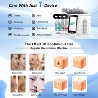 Appareil de beauté facial NEWFACE 8-en-1 pour le visage, technologie à bulles d'oxygène pour le traitement de l'acné, nettoyage en profondeur, rajeunissement de la peau