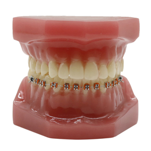 Enseñanza de dentistas demostración modelo de dientes de cuidado dental de plástico para suministro educativo - Product Image 4
