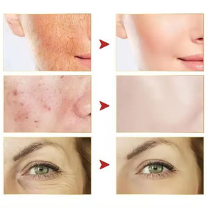 Crema Facial de Retinol OEM ODM, Cuidado de la Piel Antienvejecimiento, Blanqueadora, Hidratante, Orgánica, Vegana, Crema Facial Coreana - Product Image 4