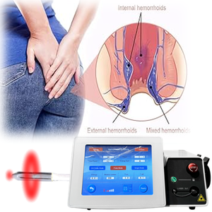 เลเซอร์โพรโทโลยี 980 1470 นาโนเมตร แบบเส้นใยเรเดียลทรงกรวย สำหรับรักษาโรคริดสีดวงทวาร ริดสีดวงทวารรั่ว ริดสีดวงทวารแบบรั่วซึม ด้วยเลเซอร์ไดโอด สำหรับแพทย์ผู้เชี่ยวชาญด้านโพรโทโลยี - Product Image 1