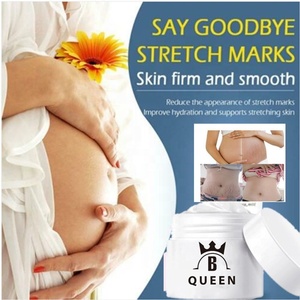 Crème pour le <span class=keywords><strong>visage</strong></span> anti-vergetures pour femmes enceintes 2023 - Product Image 4