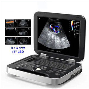 Échographie gynécologique d'ordinateur portable cardiaque d'échocardiographie médicale - Product Image 2