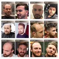 Rambut Pria Asli India 100% Hitam, Unit Prostesis Pengganti Rambut, Garis Rambut Alami, Kulit Tipis, Alas Sutra PU, Toupee Pria