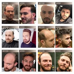 วิกผมผู้<span class=keywords><strong>ชาย</strong></span>สีดำ ทนทาน ด้านหน้าทนทาน  <span class=keywords><strong>บาง</strong></span>เบา  แบบฉีด  ราคาประหยัด  ขนาด<span class=keywords><strong>เล็ก</strong></span>  ดูเป็นธรรมชาติ  <span class=keywords><strong>ผม</strong></span>แท้ 100%  วิก PU Toupee - Product Image 6