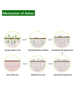 Nuove macchie scure dell'acne rimuovendo Non invasivo <span class=keywords><strong>Bio</strong></span> microneedling siero di alghe spugna microneedles per la pelle ringiovanire anti invecchiamento - Product Image 3