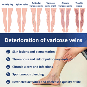 Ungüento Venous Comfort Health para Venas Rojas, <span class=keywords><strong>Piernas</strong></span> Adoloridas y Dormias, <span class=keywords><strong>Piernas</strong></span> Hinchadas y Doloridas Debido a las Várices - Product Image 5