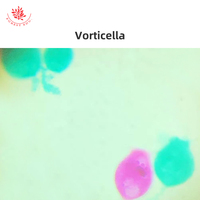 Beginner's Protozoan Microscope Slide Set