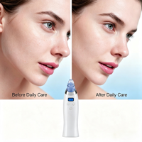 Nettoyeur de pores Comedo par aspiration, appareil de beauté pour le nez, rechargeable USB-C, portable, soin de la peau du visage