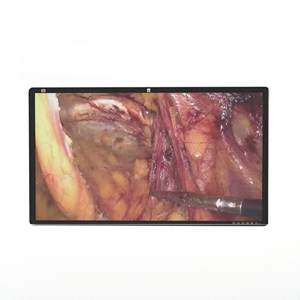 Pantalla médica grande de 55 pulgadas, monitor LCD 4K de grado médico, pantalla para laparoscopia y endoscopia veterinaria - Product Image 6
