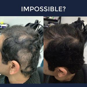 Nhà máy cung cấp xu hướng 2025 cầm tay tóc mọc lại Mũ bảo hiểm lllt laser 650nm trị liệu chống rụng tóc hạt nhân 8000bc mức thấp Laser - Product Image 5