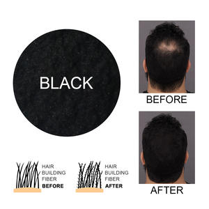 Nuovo Arrivo Fibre per Capelli Infoltenti da 27.5g Naturali e Morbide per Trattamento Contro la Calvizie e la Caduta dei Capelli - Product Image 3