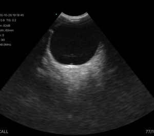 2021 baru nirkabel & usb 128 elemen portabel oftalmik peralatan ultrasonik pemeriksa Doppler warna untuk mata 8/11mhz Konted C10ue - Product Image 6