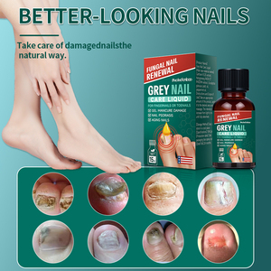 Nail Serum Professional Strength Nail Fungus Drops Thick Gray Ingrown Nails Subnail Hematoma Repairing Liquid Nail <strong>Treatment</strong> - Product Image 4