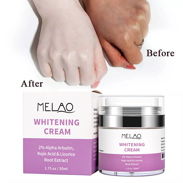 crema blanqueadora
