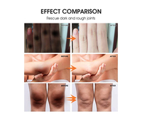 Crème correctrice de taches foncées, marque privée coréenne, soins de la peau, Niacinamide, blanchiment du visage, crème pour réparer le visage