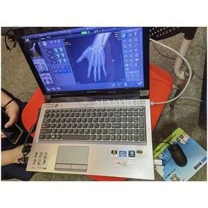 جهاز أشعة سينية طبي محمول SY-D019P، نظام تصوير رقمي طبي، جهاز أشعة سينية صغير محمول باليد - Product Image 3