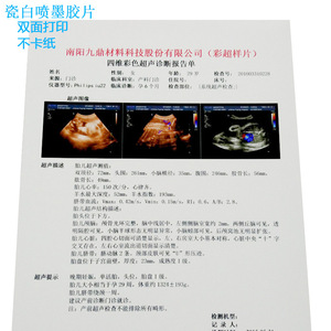 Film de transfert par sublimation Ke Fu, impression numérique, plastique, qualité médicale, imperméable, 2000 feuilles par boîte - Product Image 2