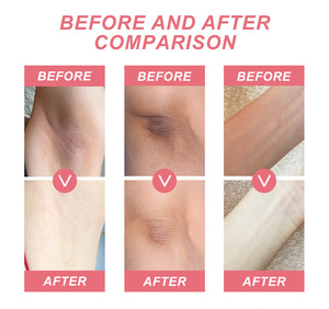 Crema blanqueadora para aclarar el cuerpo, lociones para el cuidado de la piel para axilas y partes privadas, crema blanqueadora para axilas para mujeres - Product Image 4