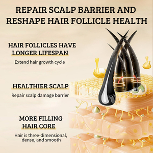 OEM ODM Sérum réparateur naturel biologique pour cheveux abîmés, huile capillaire fortifiant le cuir chevelu, anti-chute de cheveux, huile essentielle de romarin pour la <span class=keywords><strong>croissance</strong></span> des cheveux - Product Image 5