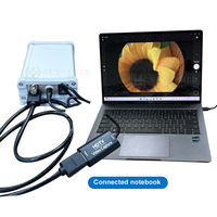 Machine d'endoscopie médicale SY-P031HD5 Caméra d'endoscope Eusb Full HD 1080P et source de lumière pour l'examen ENT