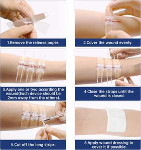 Cerotto adesivo trasparente per la chiusura delle ferite, tipo <span class=keywords><strong>Steri</strong></span>-Strip. - Product Image 5
