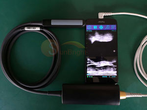 Usb Sonda De Ultrasonido Draagbare Rectale Lineaire Ultrasone Sonde - Product Image 6