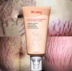 Vente en gros Best-seller Crème anti-vergetures escargot pour estomper ridules et cicatrices, lisser la peau et offrir des soins doux - Product Image 1