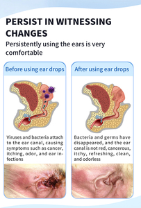 <span class=keywords><strong>Traitement</strong></span> anti-acariens écologique à action rapide pour chats et chiens, marque privée – Gouttes nettoyantes pour l'oreille, éliminent les acariens - Product Image 4