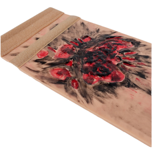 Modèle de simulation réaliste de brûlures <span class=keywords><strong>des</strong></span> membres DARHMMY BOU/CS-3, degré 3-4, pour <span class=keywords><strong>la</strong></span> <span class=keywords><strong>formation</strong></span> aux soins <span class=keywords><strong>des</strong></span> brûlures - Product Image 2