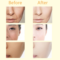 Sérum Visage Or 24K Marque Privée Hydratant Éclaircissant Soin Peau Sérum Facial Corée