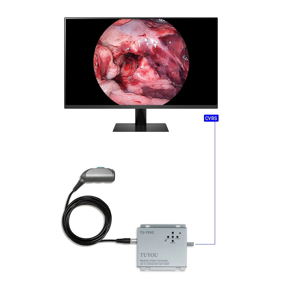 Volledige Hd 1080P Draagbare Ent Endoscopie Systeem Medische Endoscoop Camera Veterinair Voor Medische Monitor