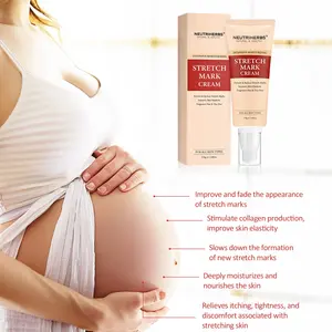 Private label skin repair remove anti-stretch mark pregnancy very effective stretch mark scar removal cream for stretch marks