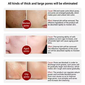 <span class=keywords><strong>LANBENA</strong></span>-Suero para tratamiento de <span class=keywords><strong>poros</strong></span>, suero hidratante para el cuidado de la piel, eliminación de espinillas, reparación de <span class=keywords><strong>poros</strong></span>, 15 ml - Product Image 5