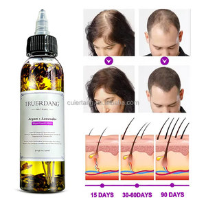 Superventas, 120ml, logotipo personalizado, biotina, crecimiento del cabello, hierbas orgánicas naturales suaves, hierbas para el crecimiento del cabello, aceite de etiqueta privada - Product Image 5