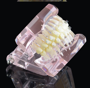 Khoa Học Y Tế Tài Nguyên Giảng Dạy Thiết Bị Giáo Dục Mô Hình Nha Khoa Tiêu Chuẩn Thông Thường, Mô Hình Giải Phẫu Răng Người Tiên Tiến - Product Image 4