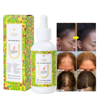 Créez votre propre logo – Huile de croissance capillaire, sérum anti-chute, élixir capillaire au gingembre, sérum stimulant la pousse des cheveux