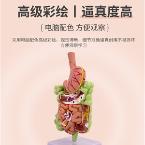 Modèle de simulation pédagogique de la pathologie du côlon humain, des maladies gastro-intestinales, des lésions du côlon, des maladies intestinales, des lésions du côlon - Product Image 3