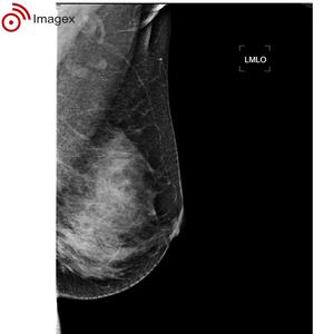 Mammographie numérique compatible CAO pour le dépistage vétérinaire et médical - Product Image 4