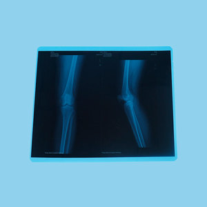 <span class=keywords><strong>AGFA</strong></span> DRYSTAR Película seca médica Materiales de impresión de alta calidad - Product Image 5