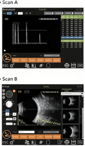 ESCÁNER ULTRASÓNICO AB SHTOPVIEW PARA OFTALMOLOGÍA - Product Image 6