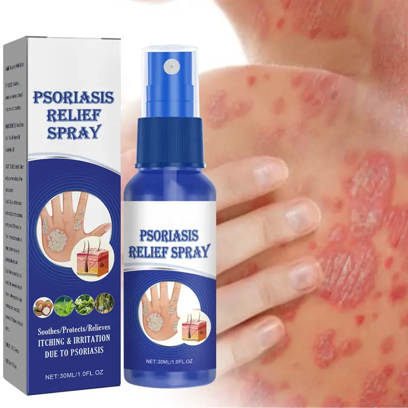 Bệnh vẩy nến treamnet phun chẩn đoán ngứa cứu trợ eczema phát ban nổi mề đay desquamation nấm nhiễm trùng da chống nấm phun