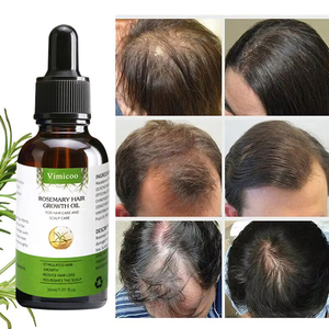 OEM ODM Sérum réparateur naturel biologique pour cheveux abîmés, huile capillaire fortifiant le cuir chevelu, anti-chute de cheveux, huile essentielle de romarin pour la <span class=keywords><strong>croissance</strong></span> des cheveux - Product Image 1
