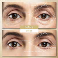 Patchs de beauté pour les yeux à microcourant et vibration, lumière rouge, pour massage oculaire à domicile – Fournisseur d'usine en gros