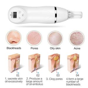 Appareil de microdermabrasion portable pour l'élimination des points noirs, peeling au diamant, massage facial par dermabrasion au diamant - Product Image 4