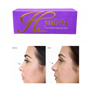 2*<span class=keywords><strong>1</strong></span>.1ml Gel de Ácido Hialurónico Reticulado Relleno Dérmico Profundo para Realce Natural de Nariz, Mentón y Labios - Product Image 3