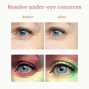 Maschera e Patch per Occhi in Gel Cristallino PDRN con Logo Personalizzato, Illuminante, Rassodante, Antirughe, Idratante, Sbiancante per la Cura della Pelle Sotto gli Occhi - Product Image 5