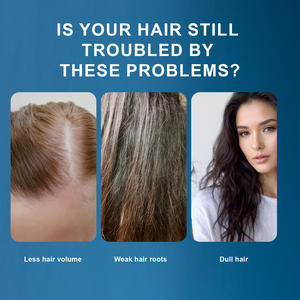 Укрепляет корни волос/кожу головы 30 мл питательное увлажняющее медное пептидное масло сыворотки волос с медным Tripeptide-1 - Product Image 2