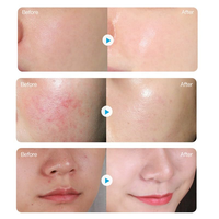 Soins de la peau Masques faciaux hydratants en profondeur Beauté Masque facial à la vitamine C blanchissant