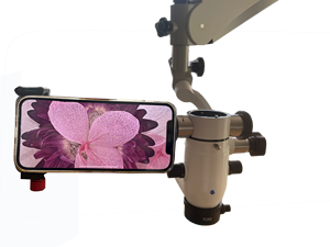 Adaptateur de téléphone portable universel, pour <span class=keywords><strong>microscope</strong></span> chirurgical, adaptateur vidéo de Smartphone, jumelles - Product Image 2